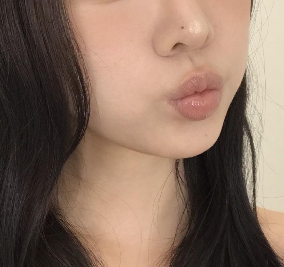 後