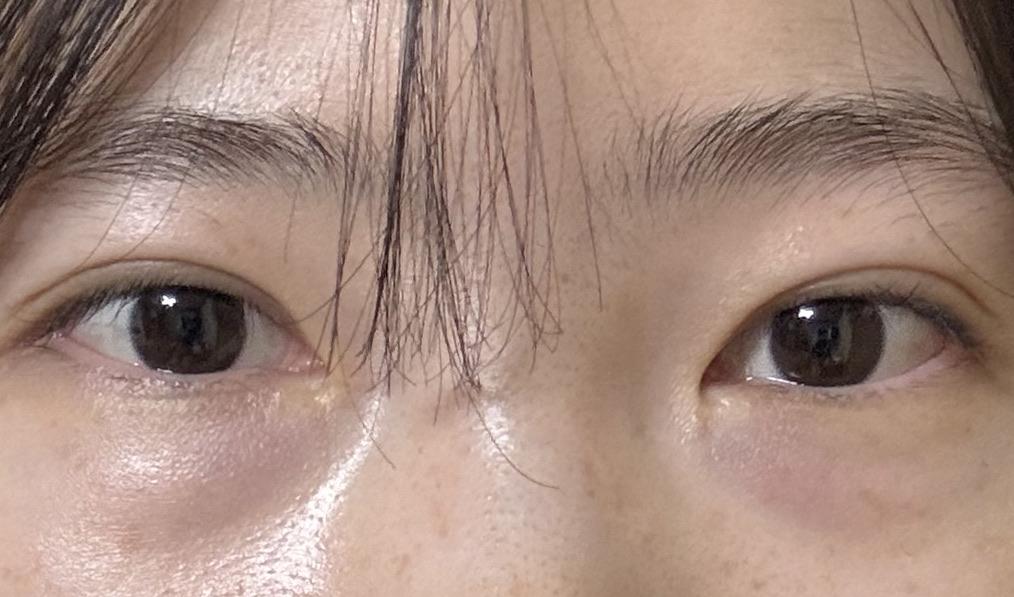 後