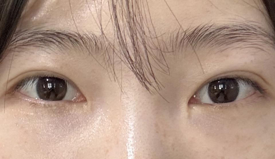 後