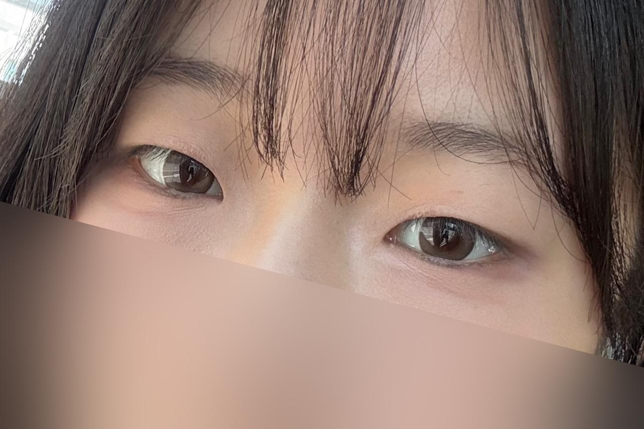後