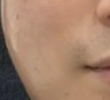 後
