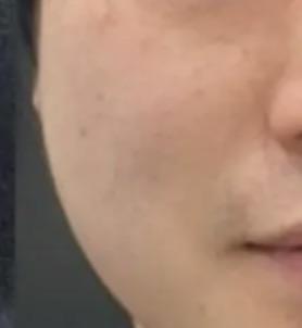 後