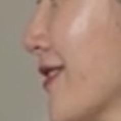 後