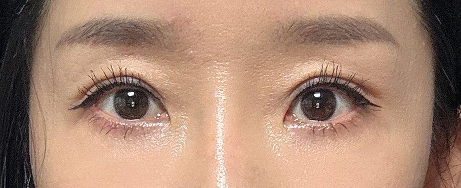 後