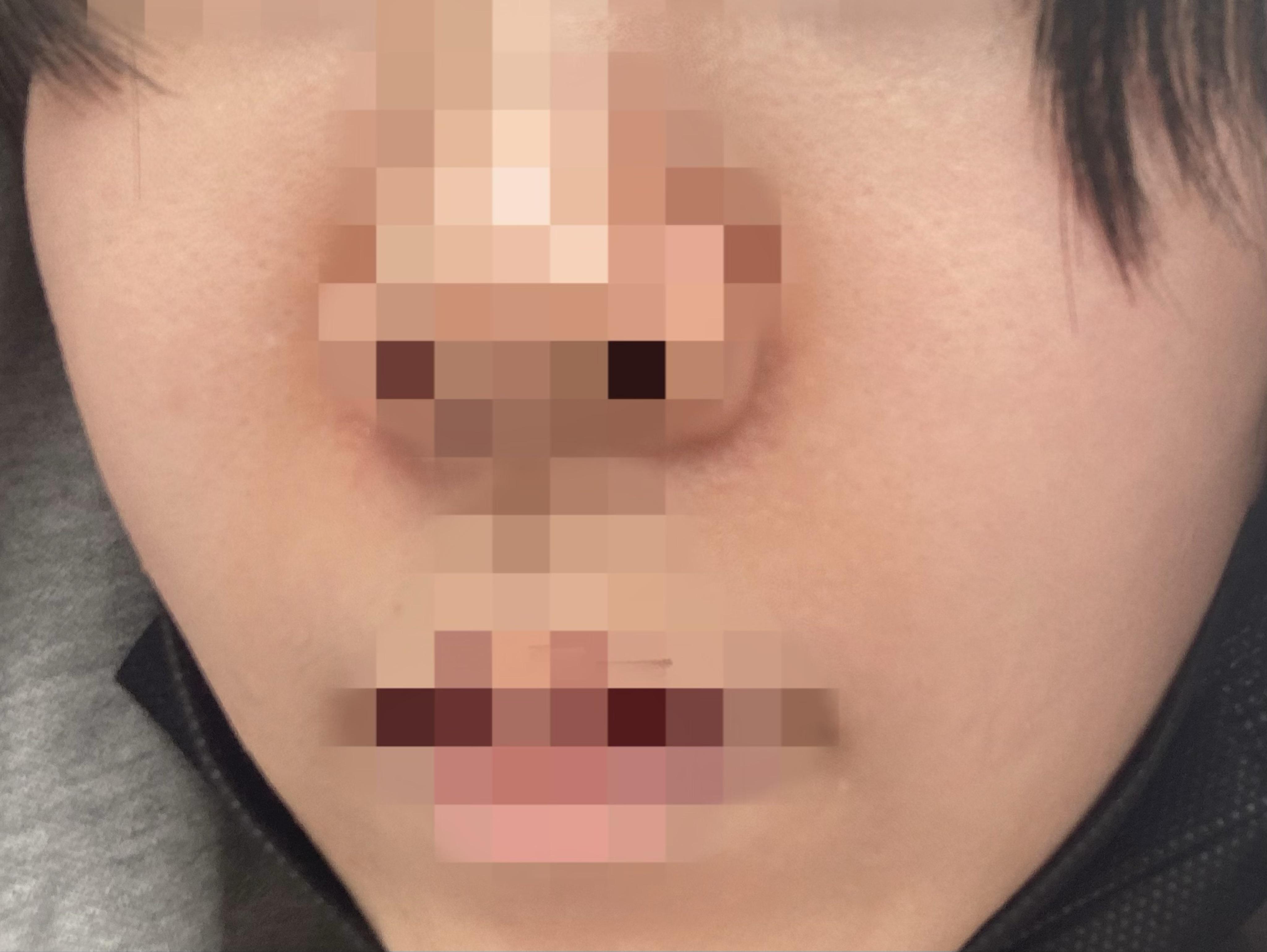 後