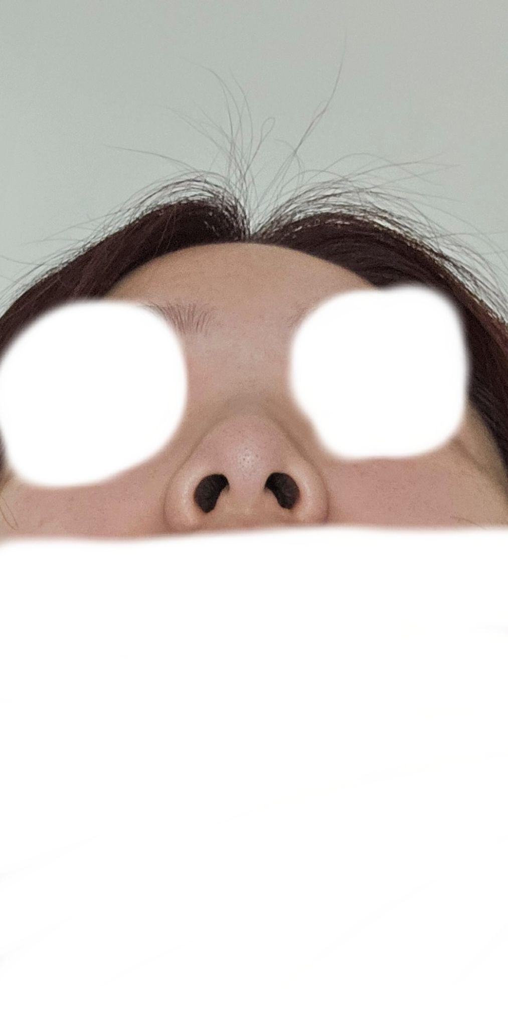 後
