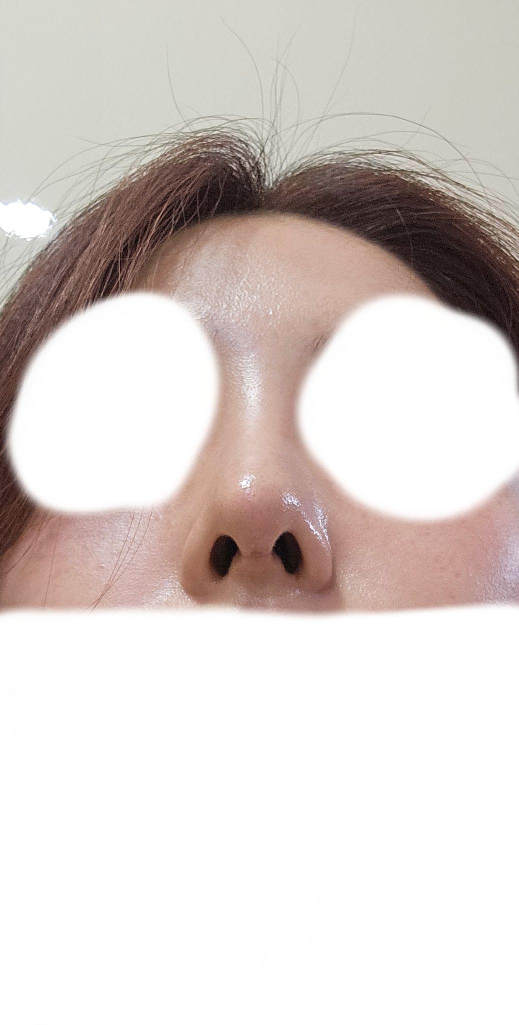 後