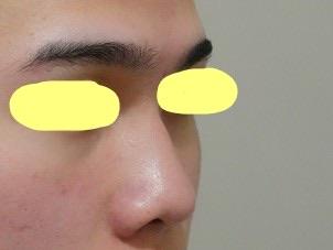 後