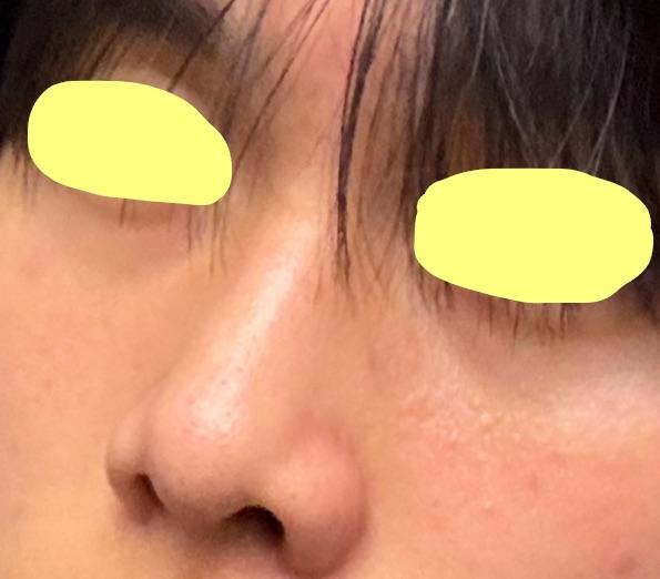 後
