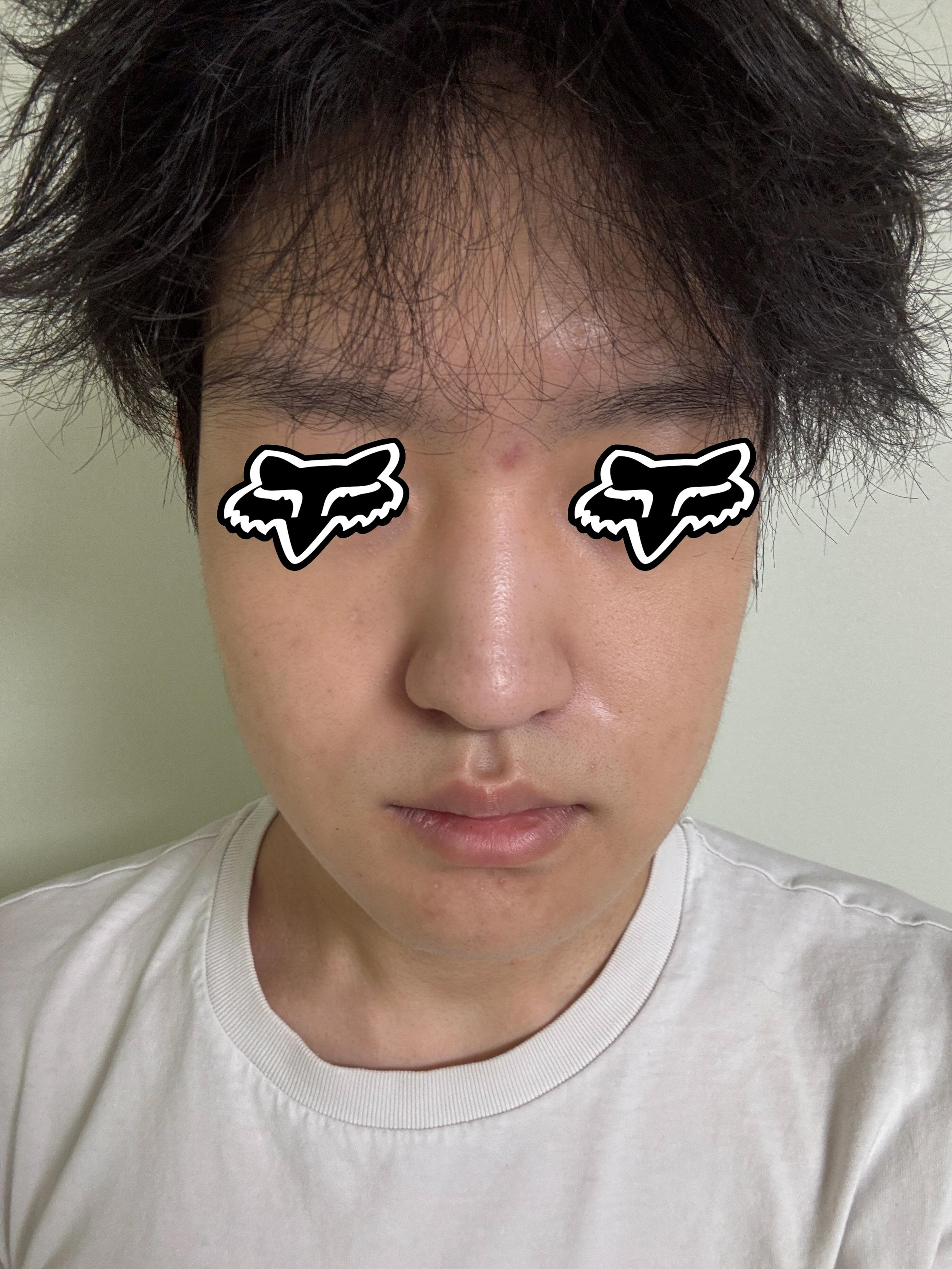 後