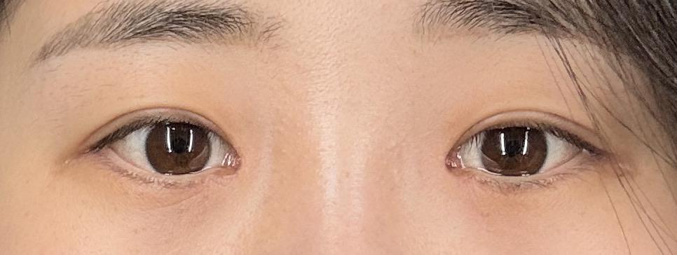 后
