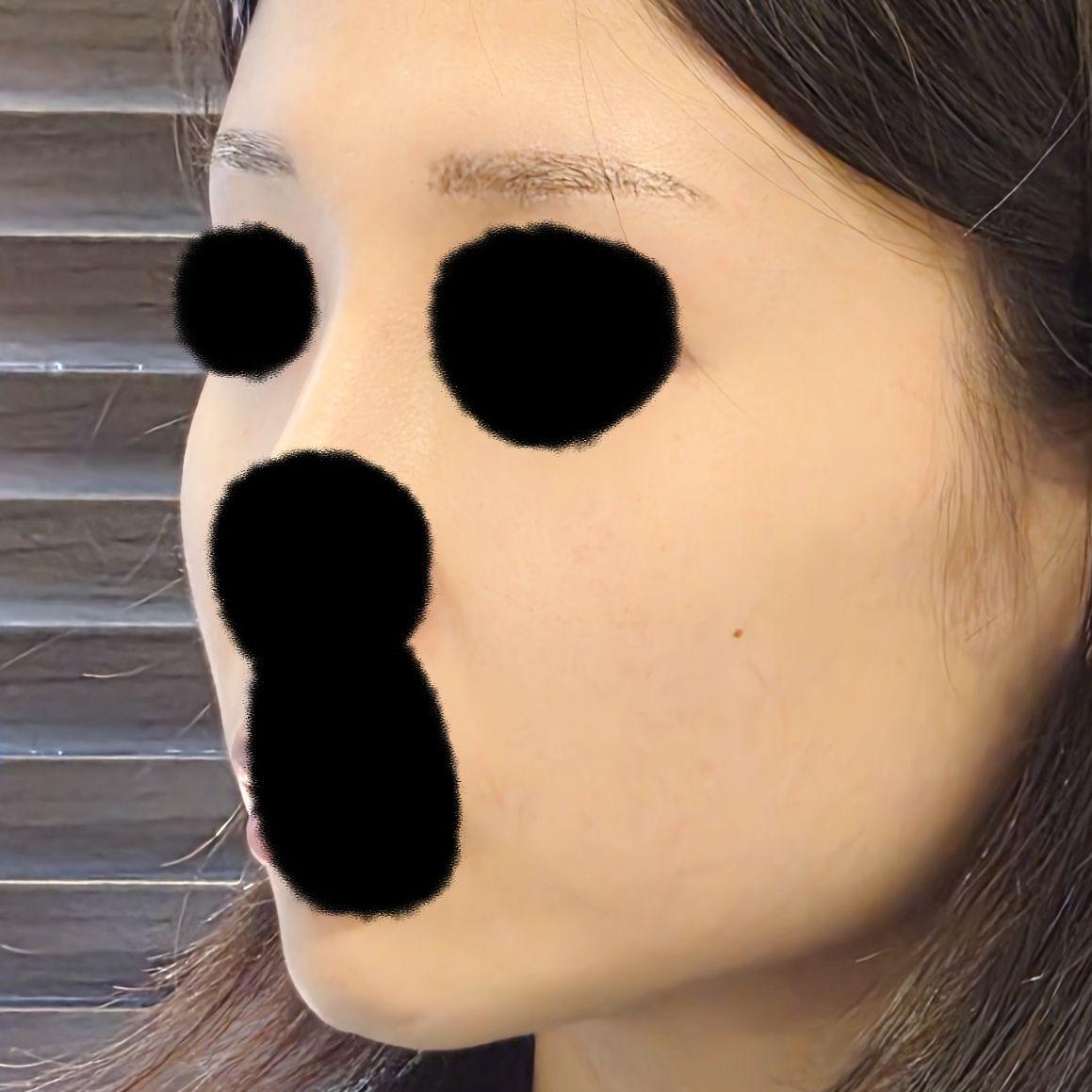 後