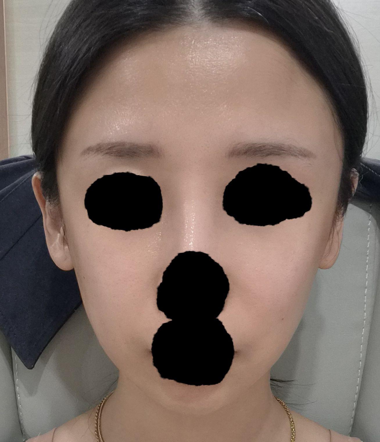 後
