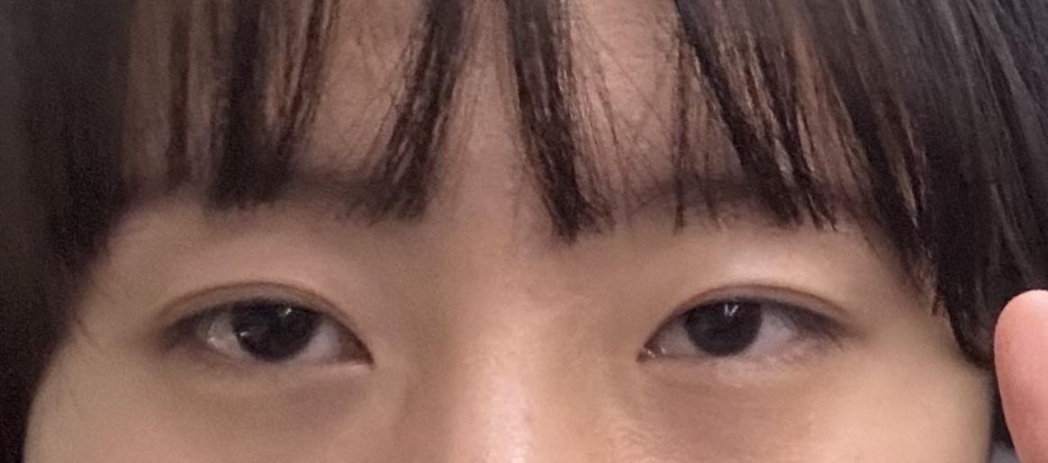 後