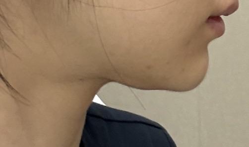 前