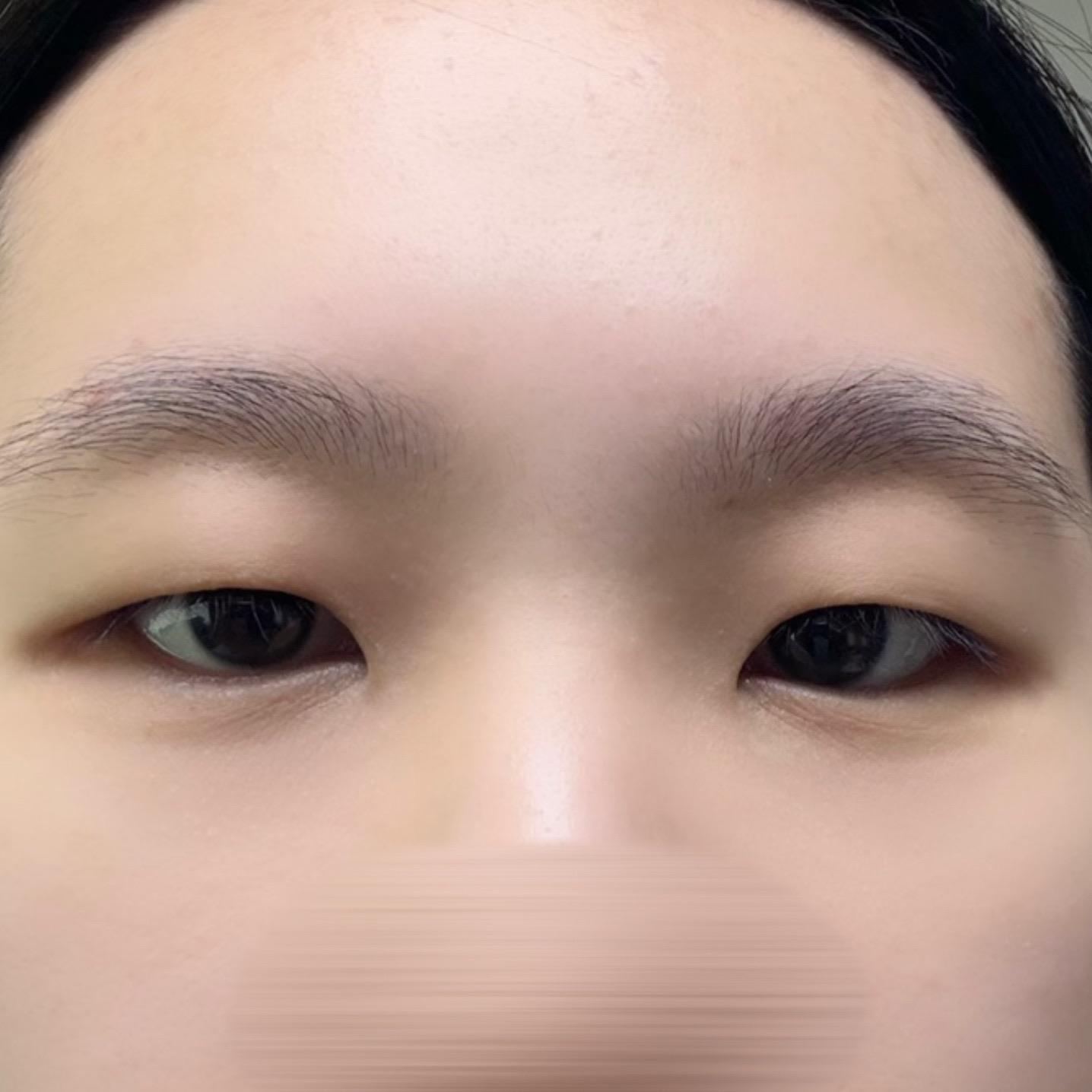 後
