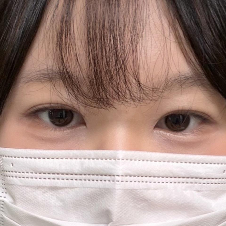 後