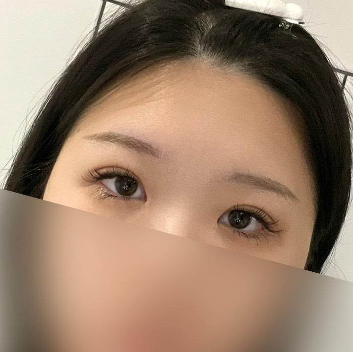 後