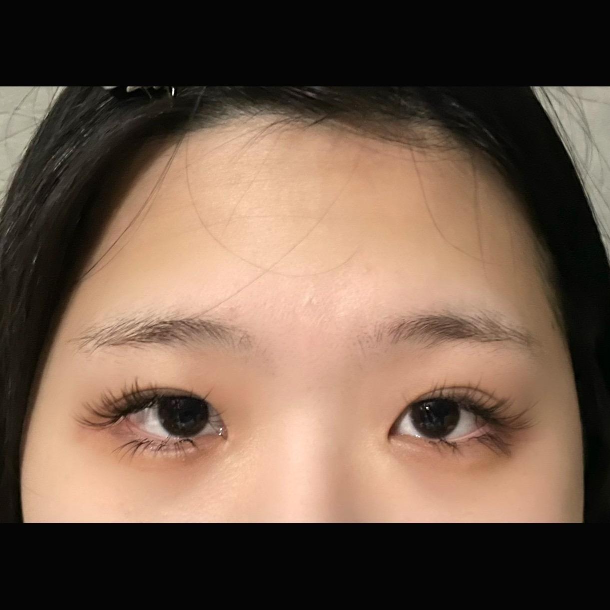 後