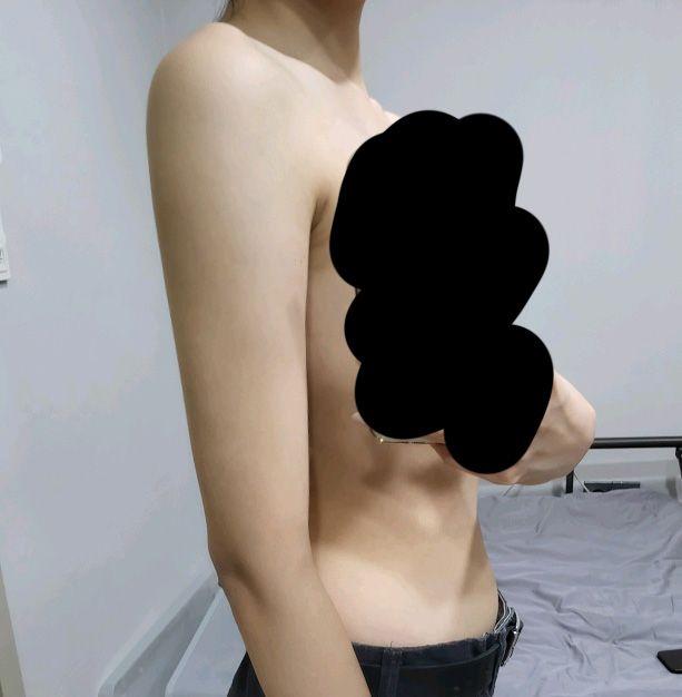 後