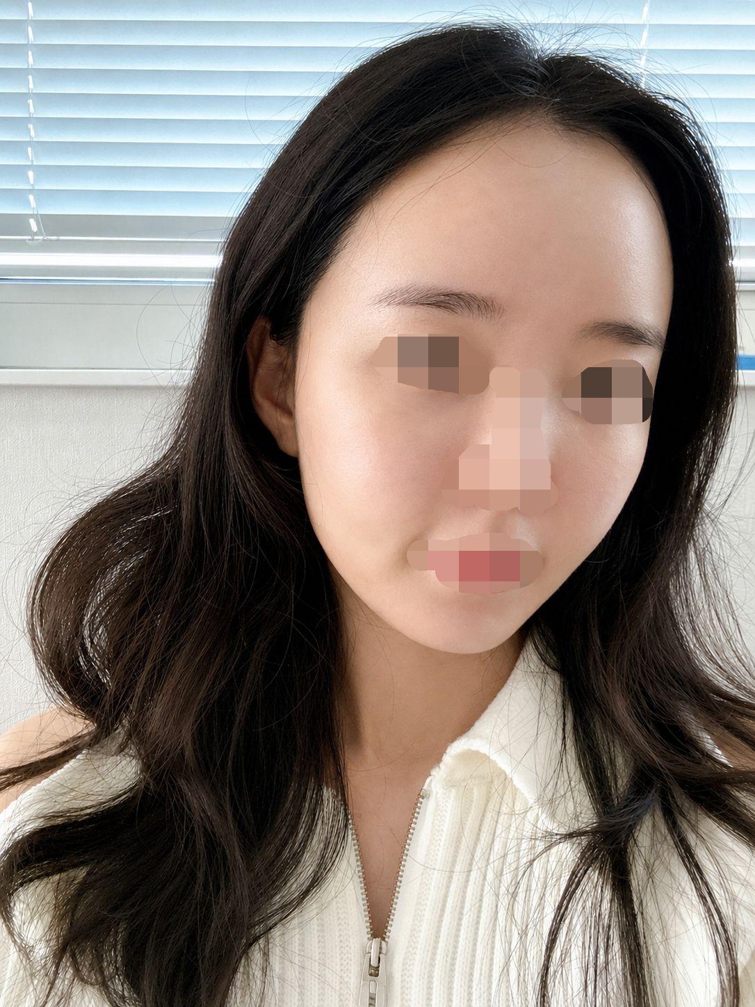 後