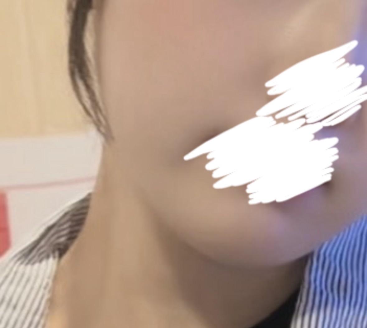 後