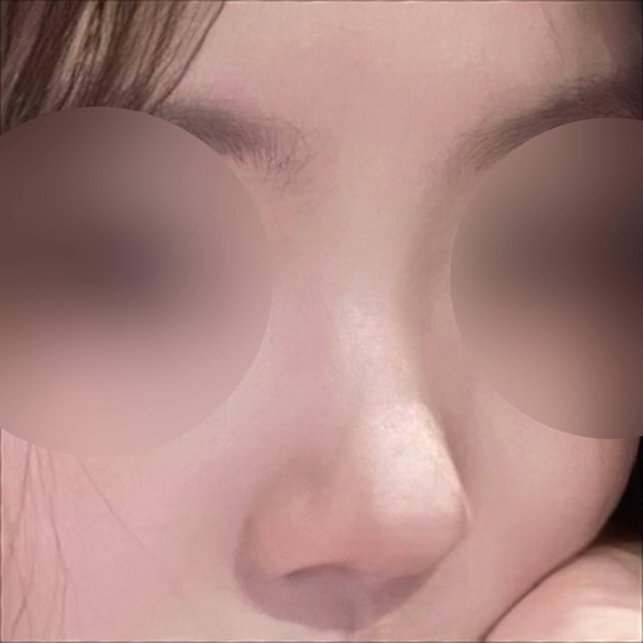 後