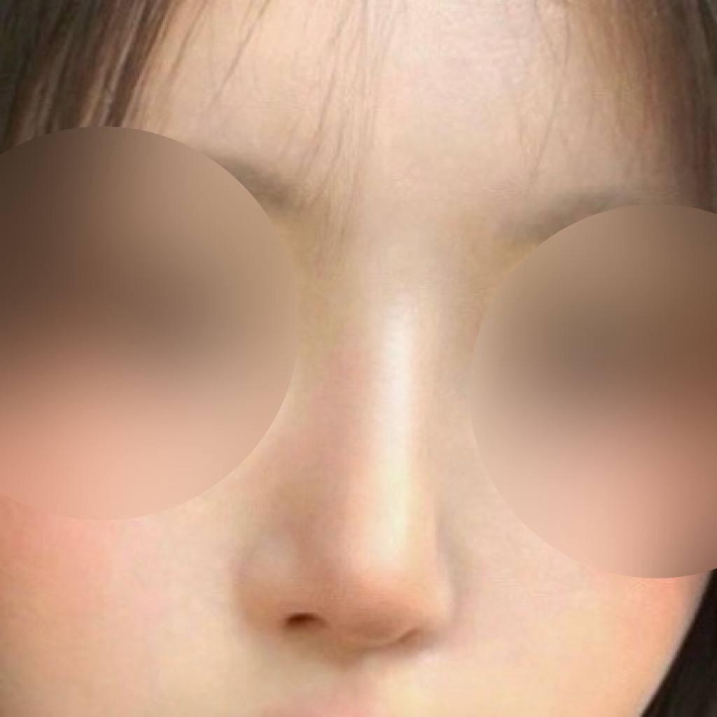 後