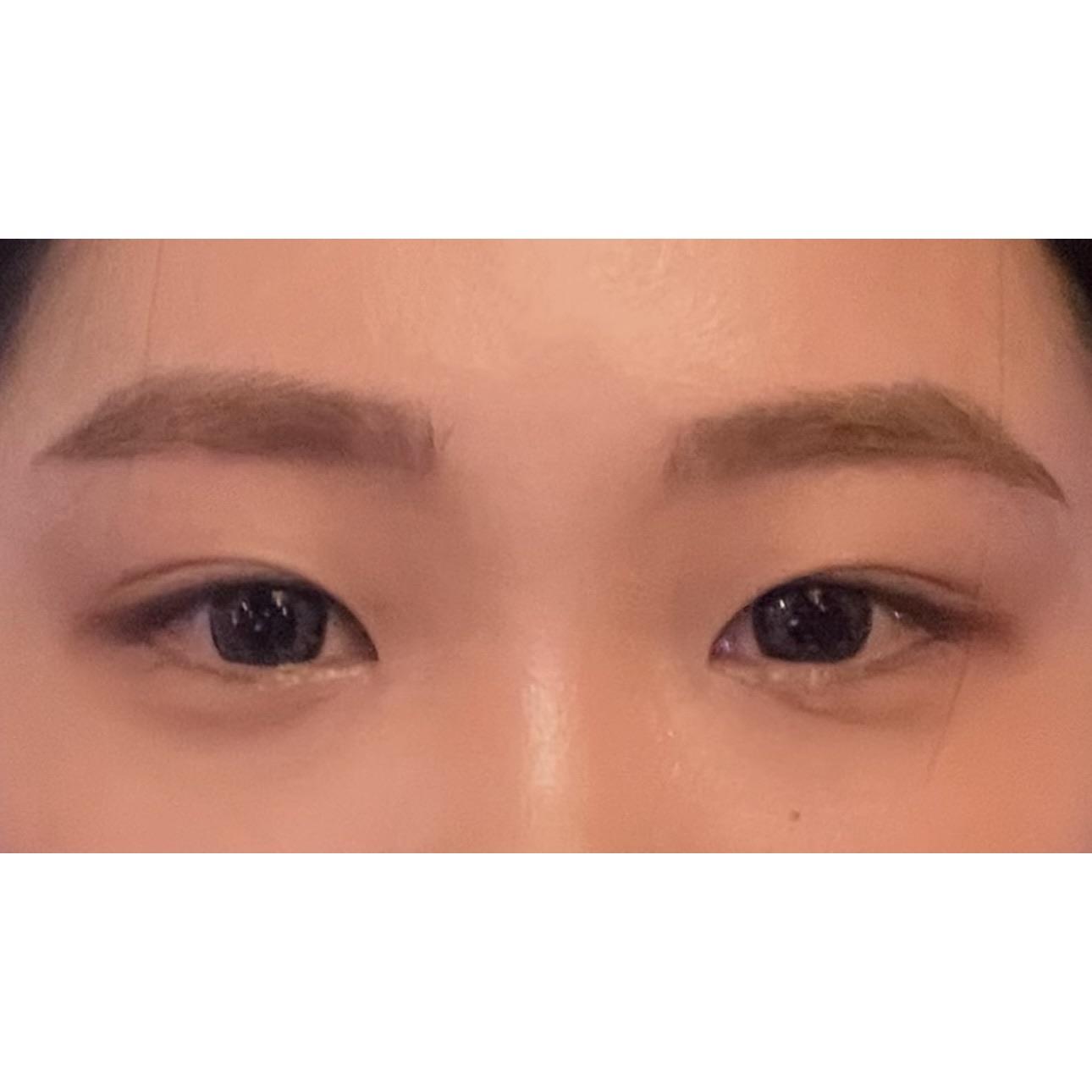 後