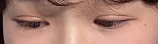 後