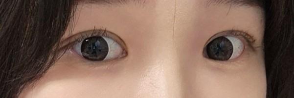 後