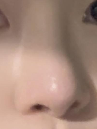 後