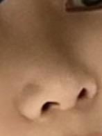 後