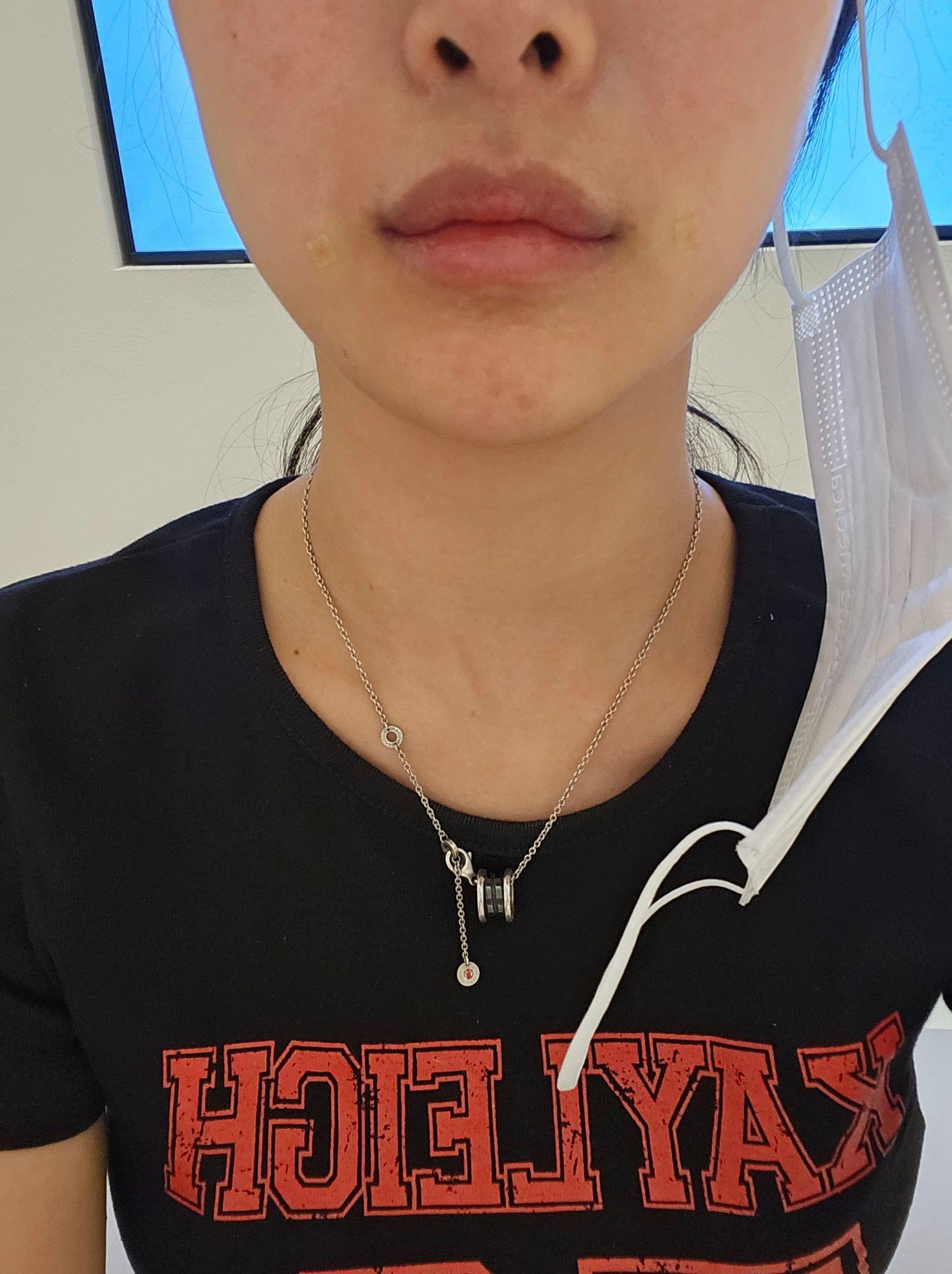 後