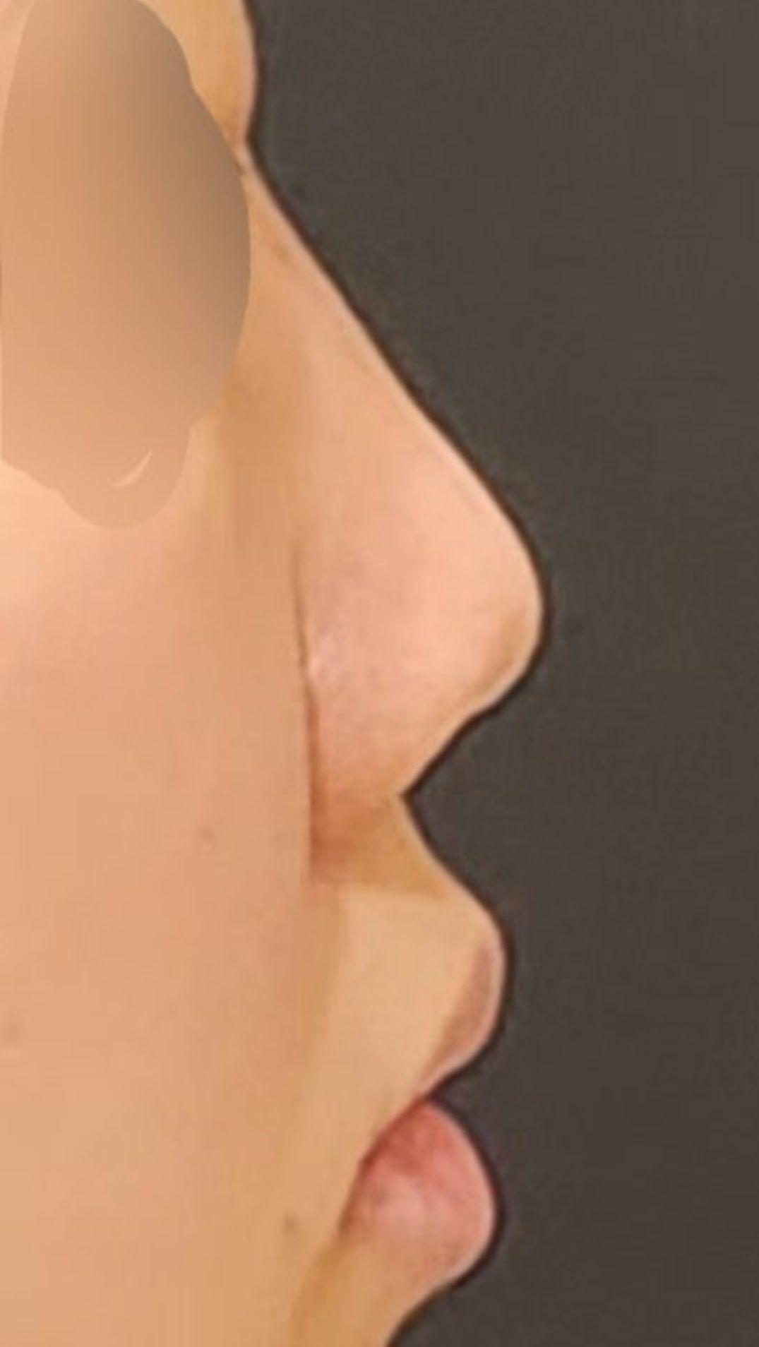 後