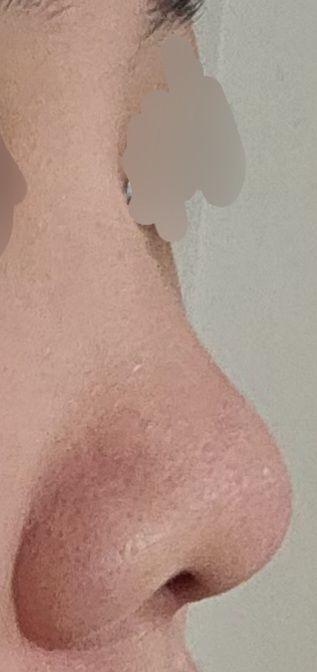 後