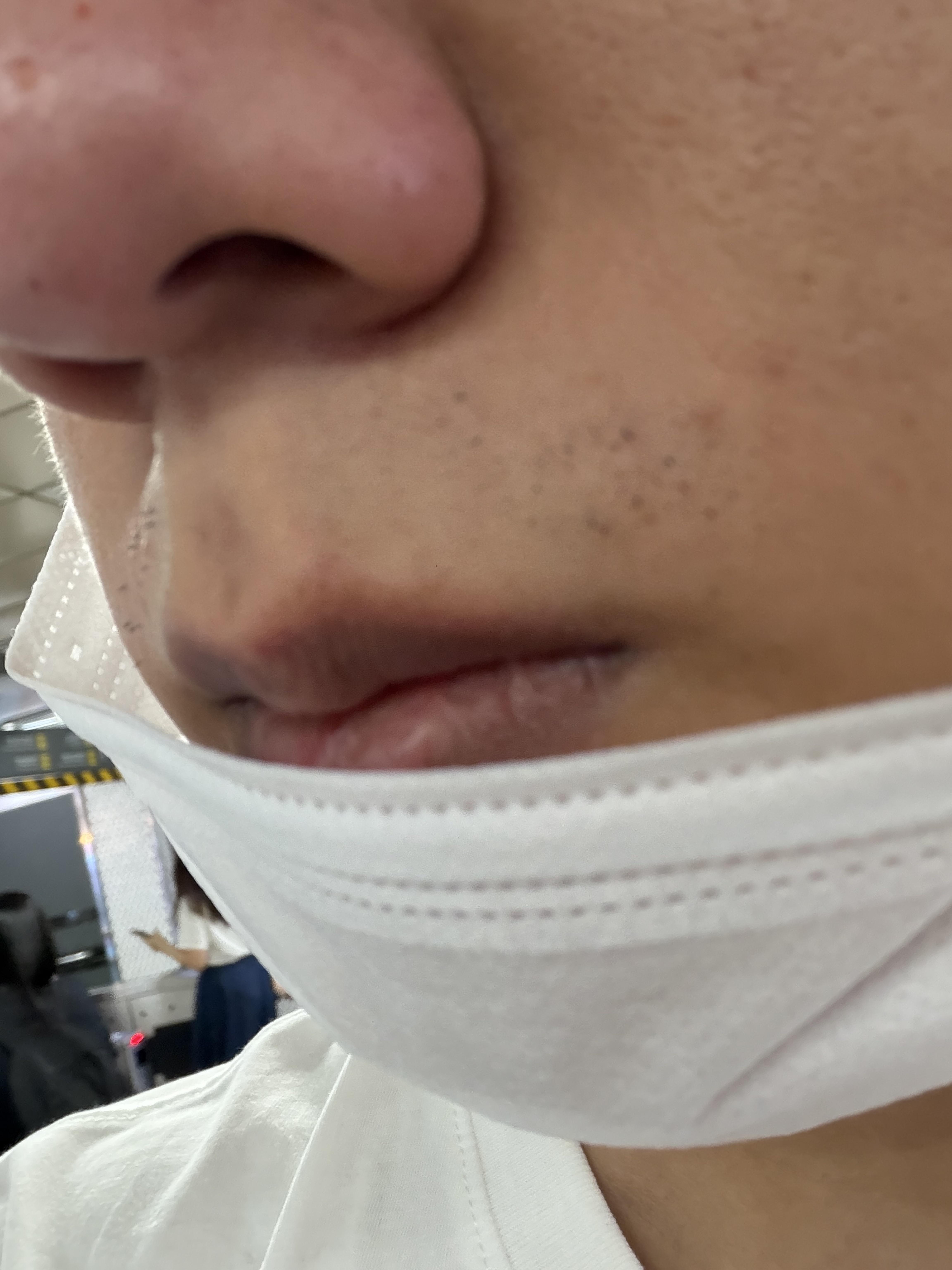 後
