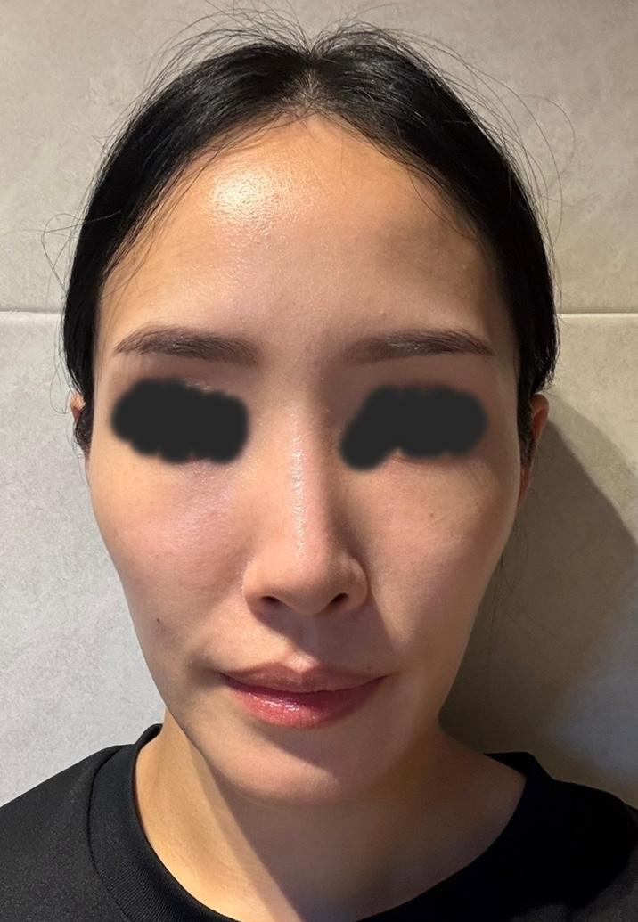 後