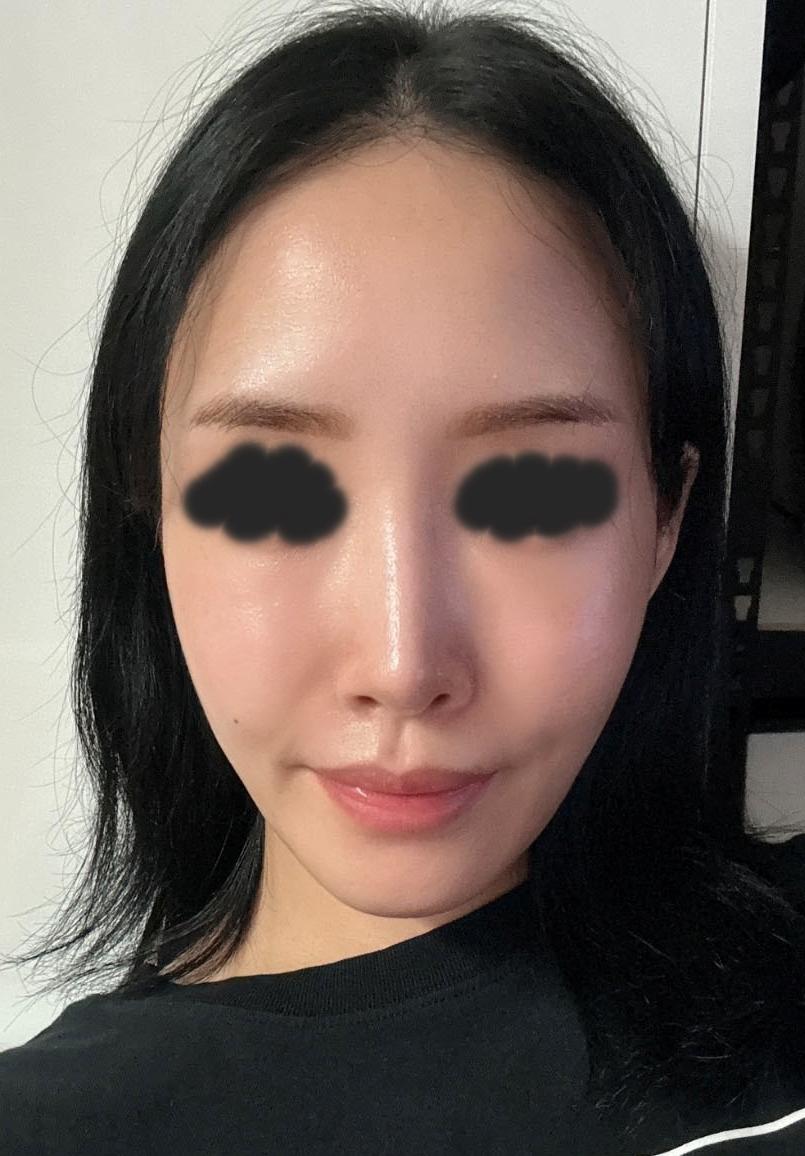 後