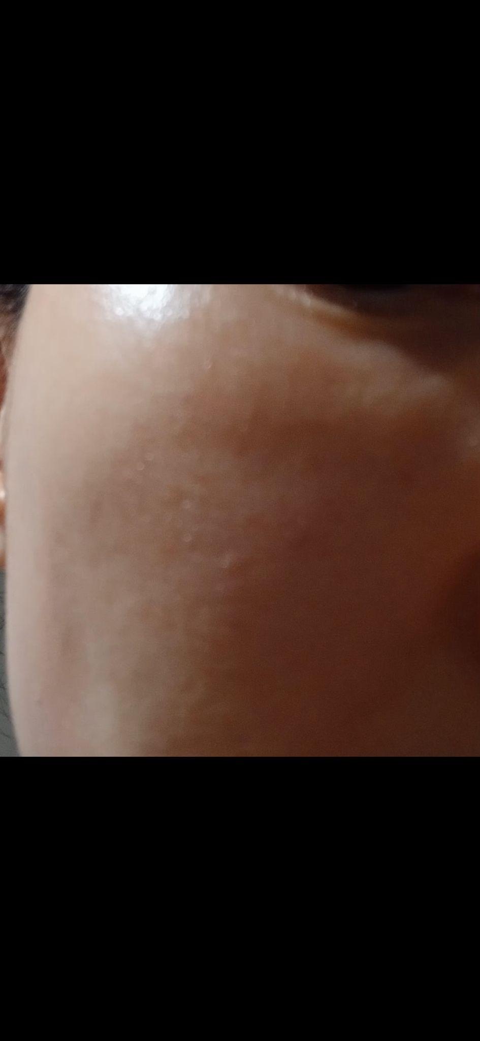 后