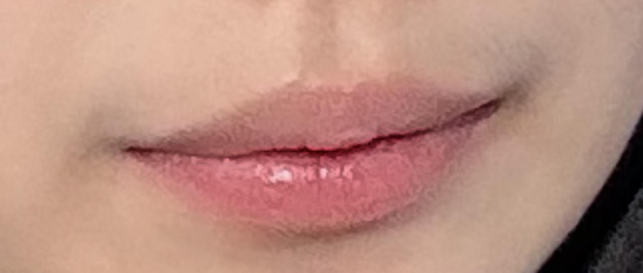 後