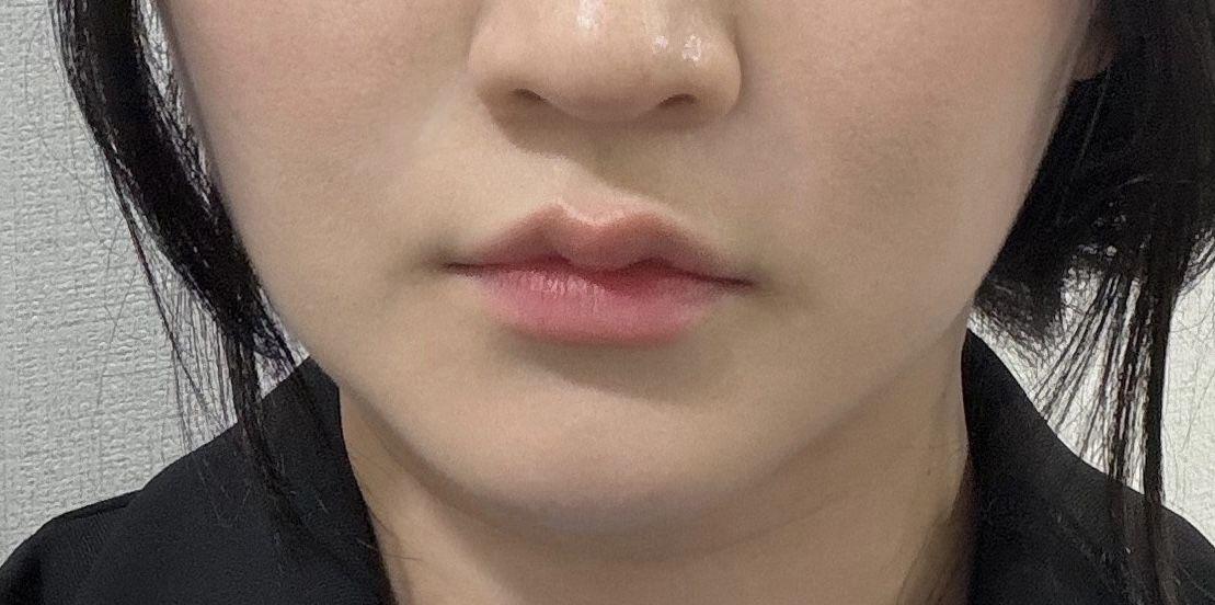 後