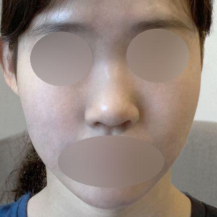 後