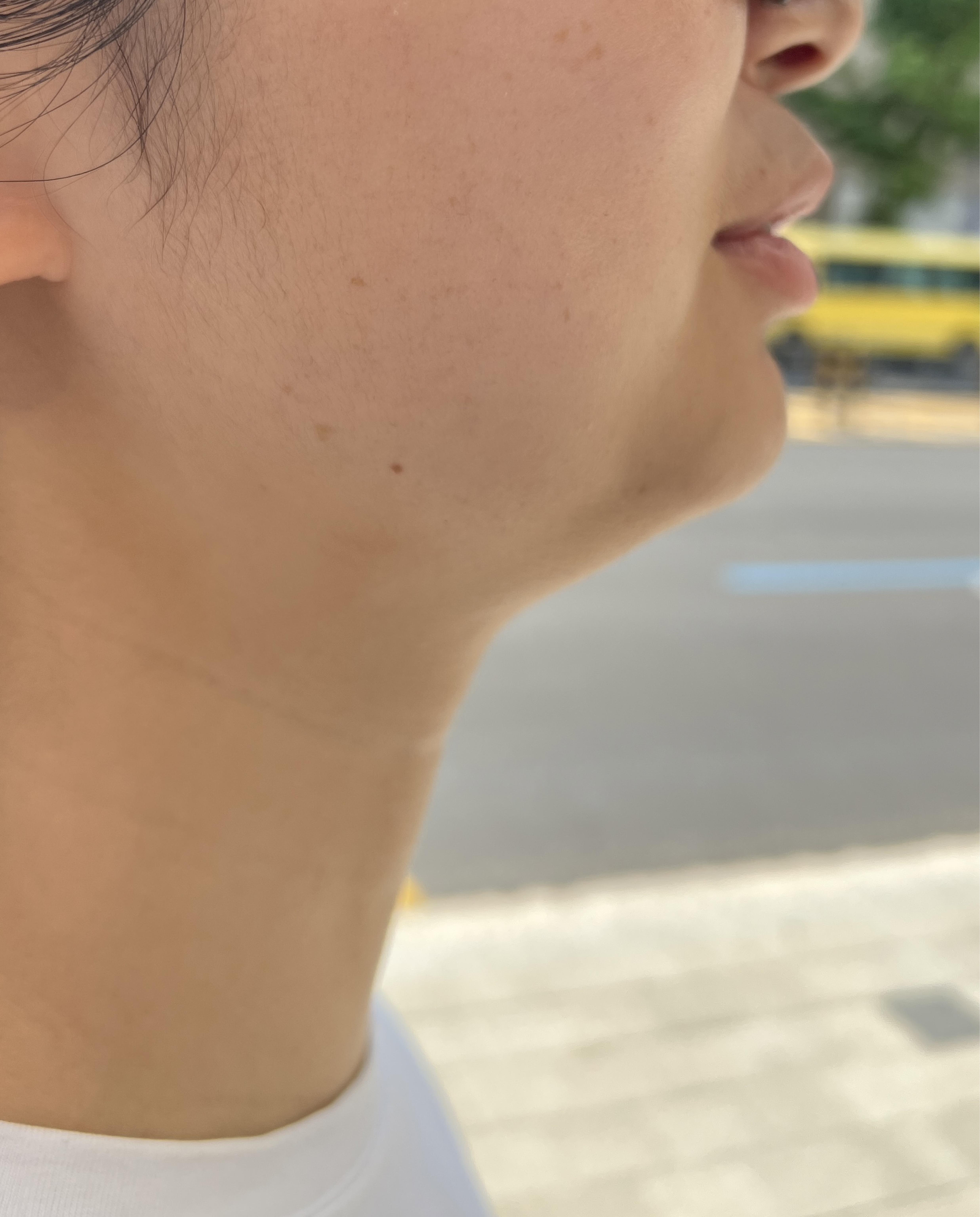 後