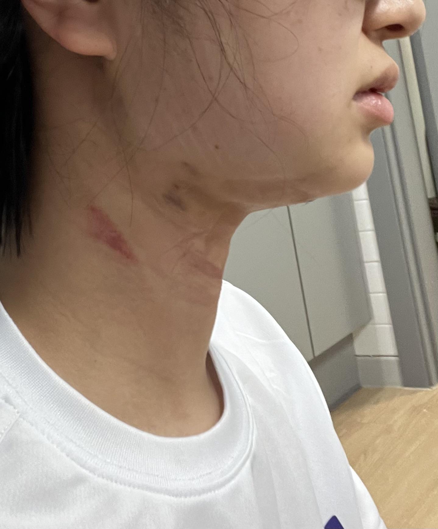 後