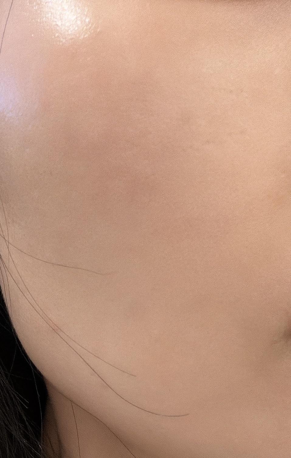 后