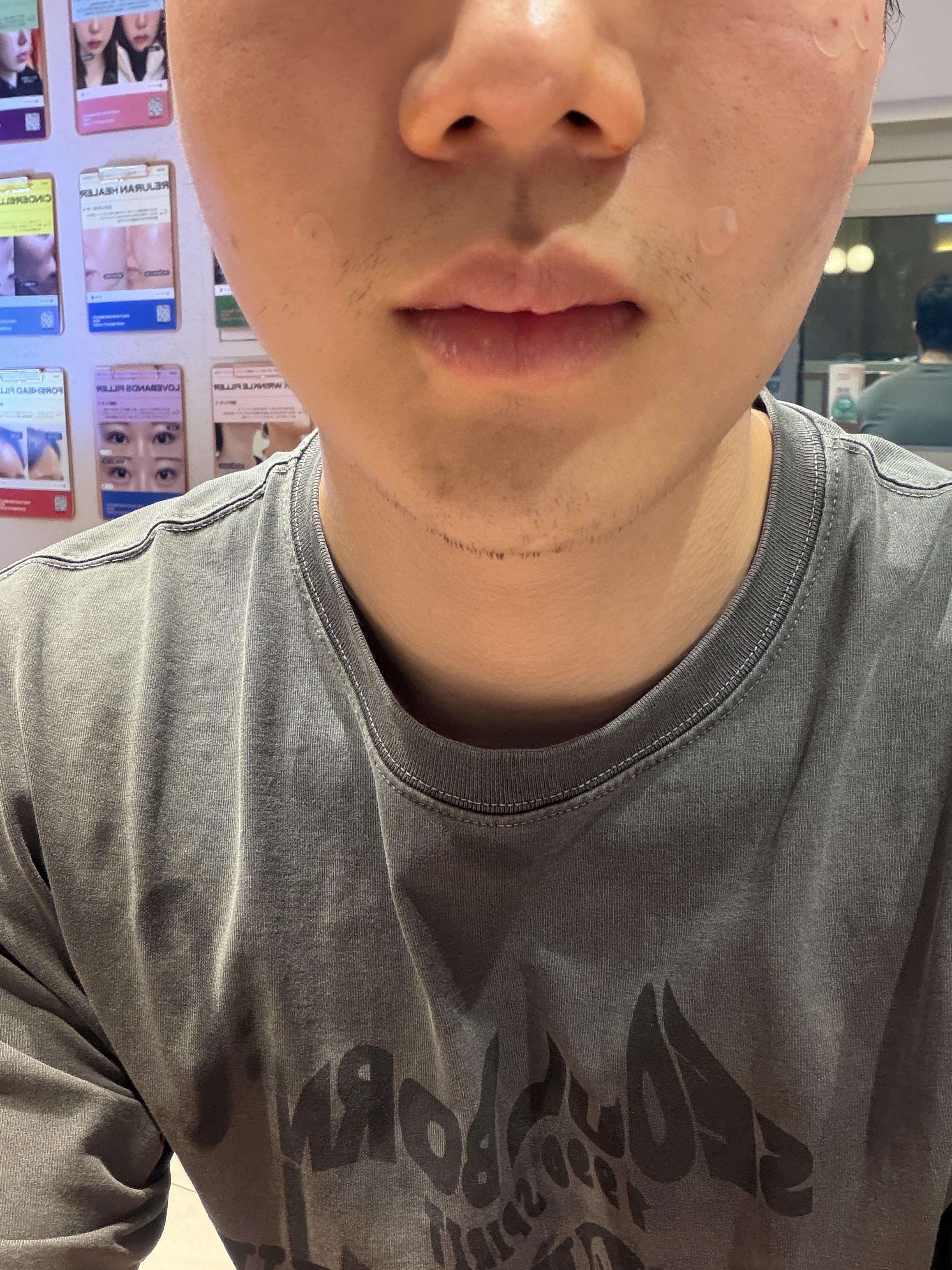 後