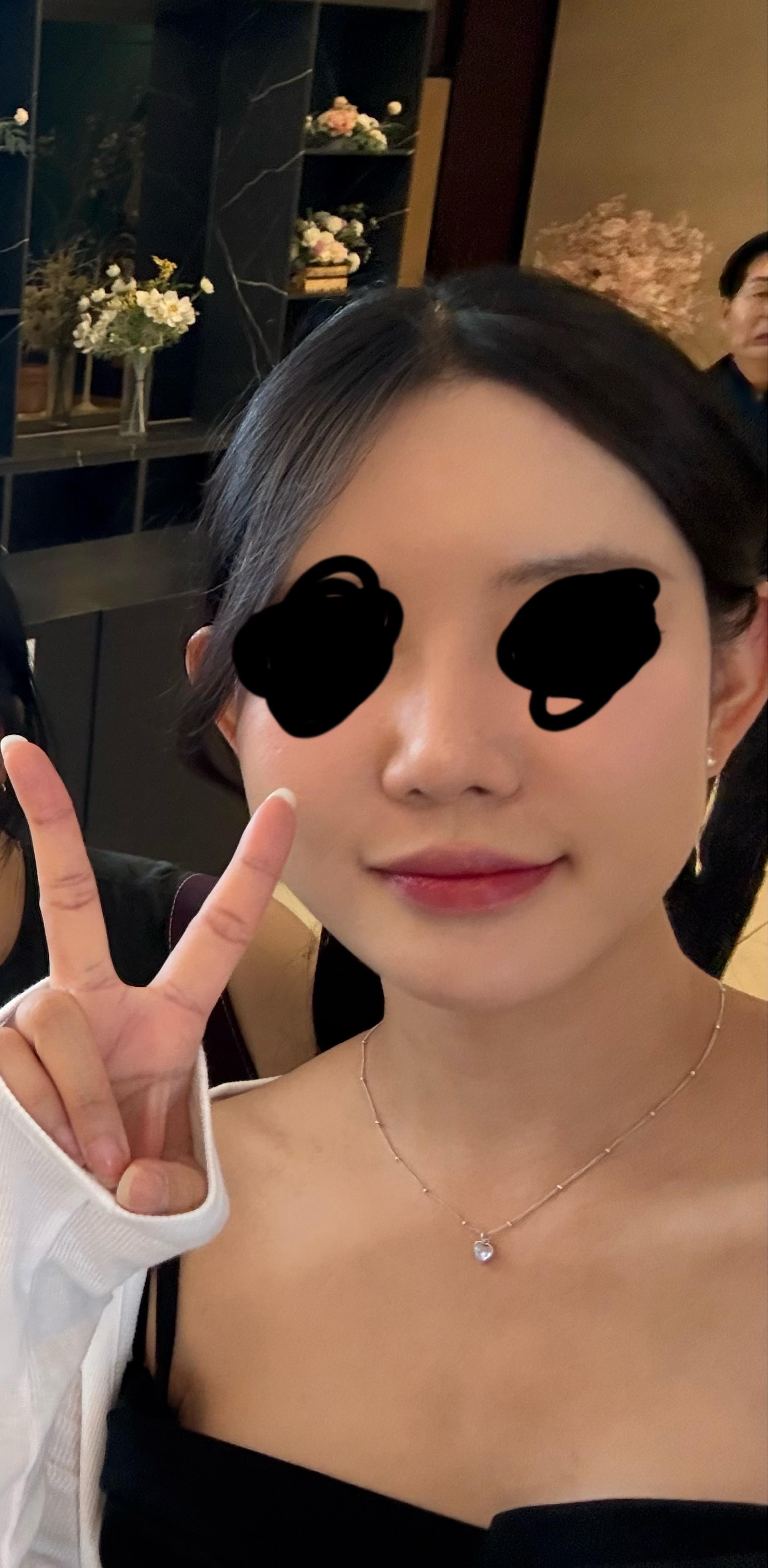 後