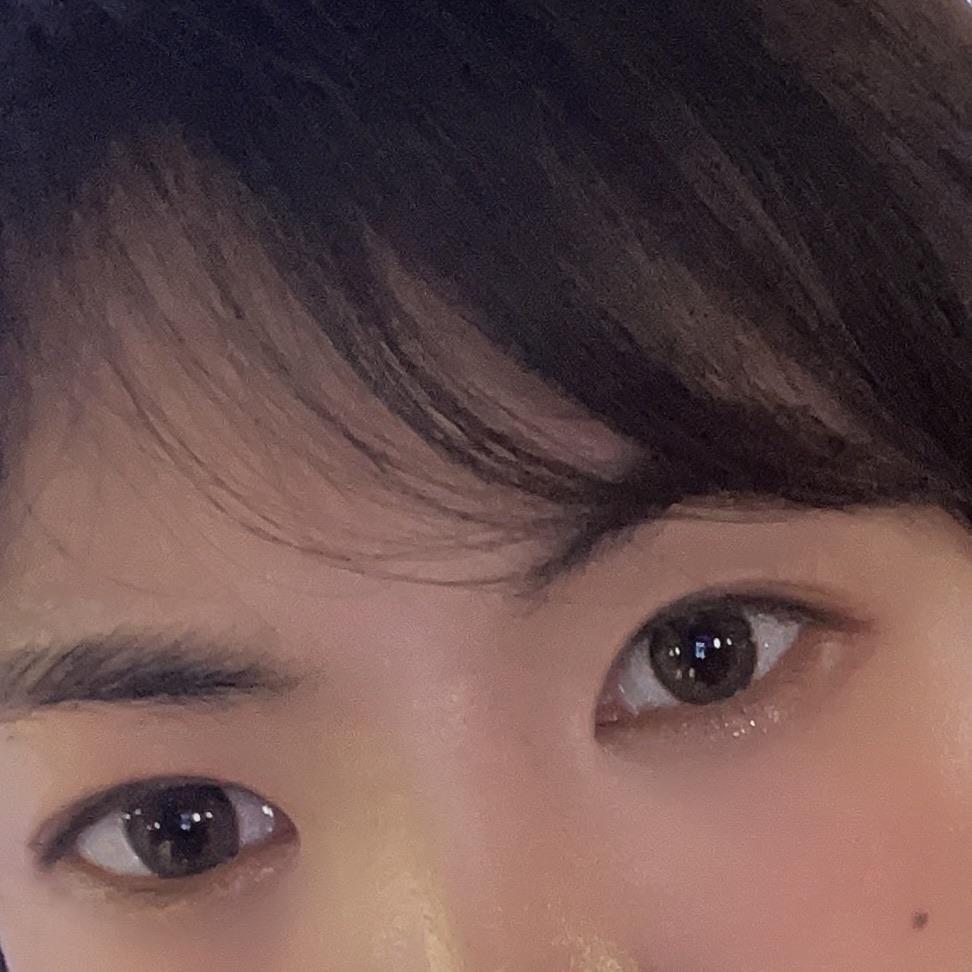 後