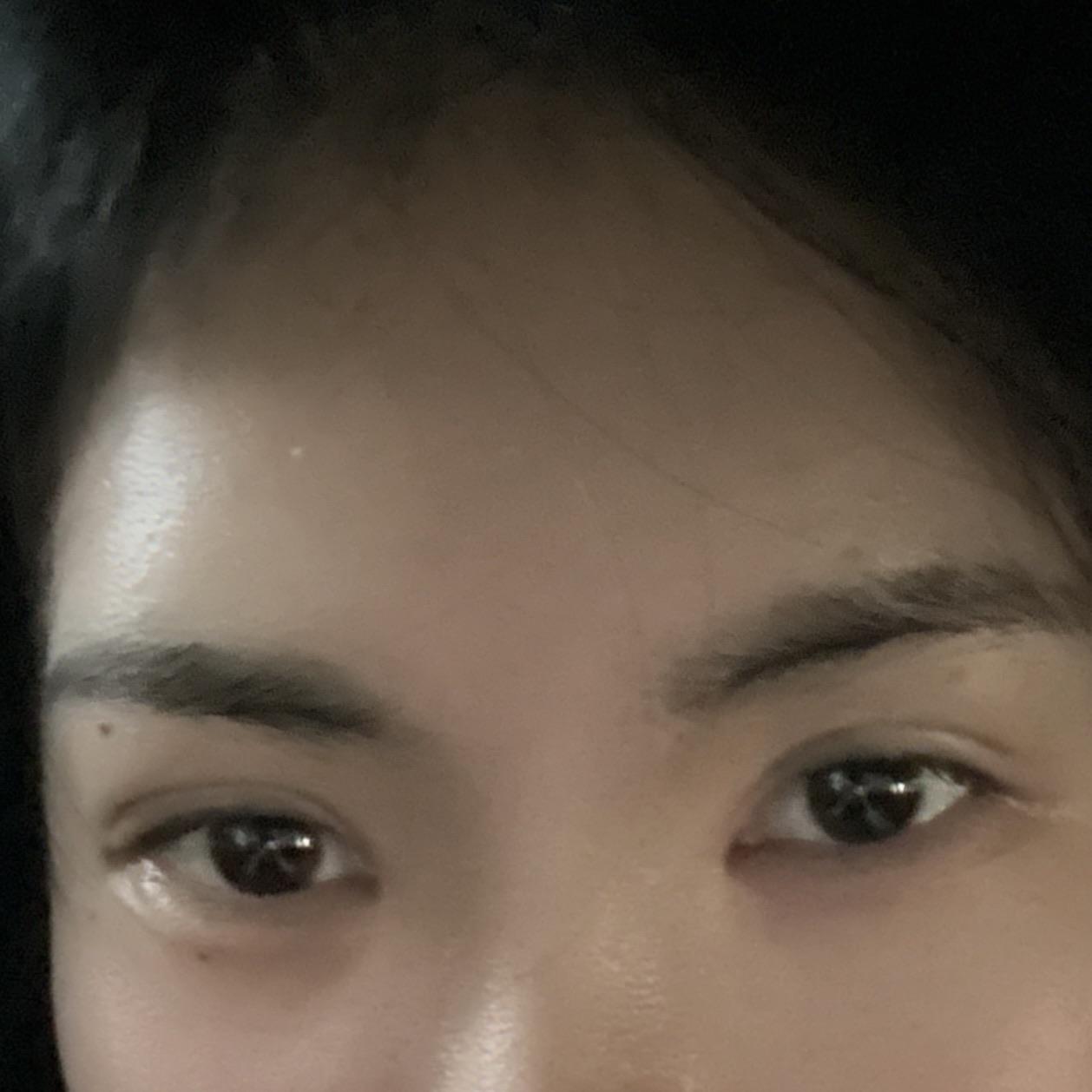後